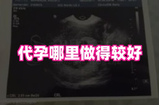 长春助孕网 4